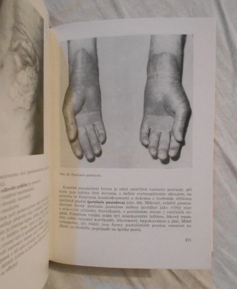 Zdeněk Šťáva, Lubor Jirásek - Dermatovenerologie - Praha 1982