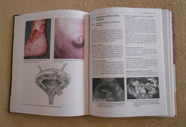 Adam a kol. - Diagnostické a léčebné postupy u maligních chorob - 2002